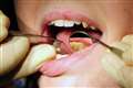 Bupa Dental Care to cut 85 practices in a move affecting 1,200 staff