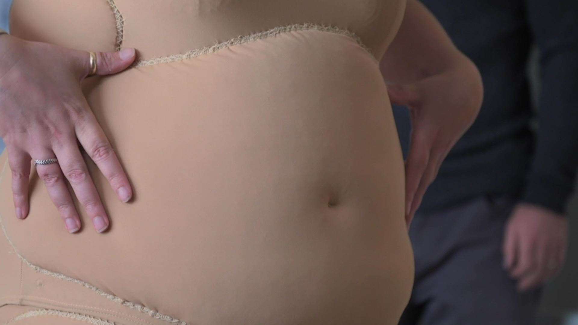 Body suit worn by Lisa for 12 weeks. Picture: BBC Scotland