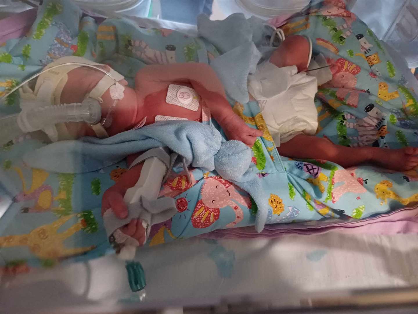 The twins first day in their incubators and on the CPAP (continuous positive airway pressure) machine.
